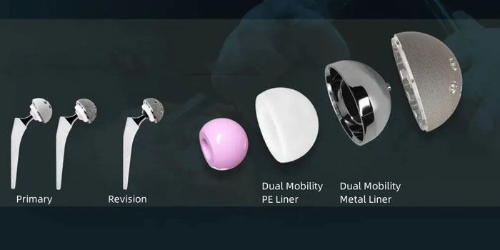 Reverse Shoulder Replacement